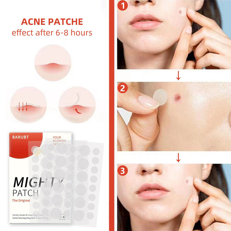 72 Count Acne Scar Patch,Nighttime Spot Stickers For Face And Skin,Shrinking Zits And Whiteheads by Josla
