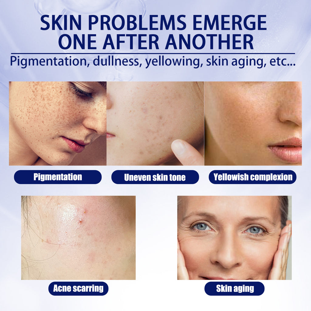 EELHOE Anti-aging Vitamin C Facial Essence, Reduces Spots Acne Fine Lines, Moisturizes Facial Essence by Josla