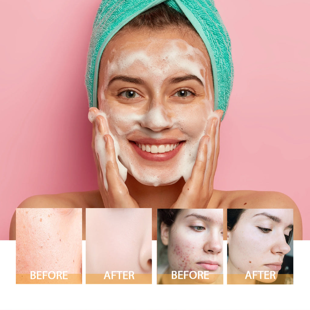 Turmeric Brightening Facial Cleanser Foam With Built-in Brush, Deep Pore Cleansing, Moisturizing Soft Skin For All Skin Types by Josla