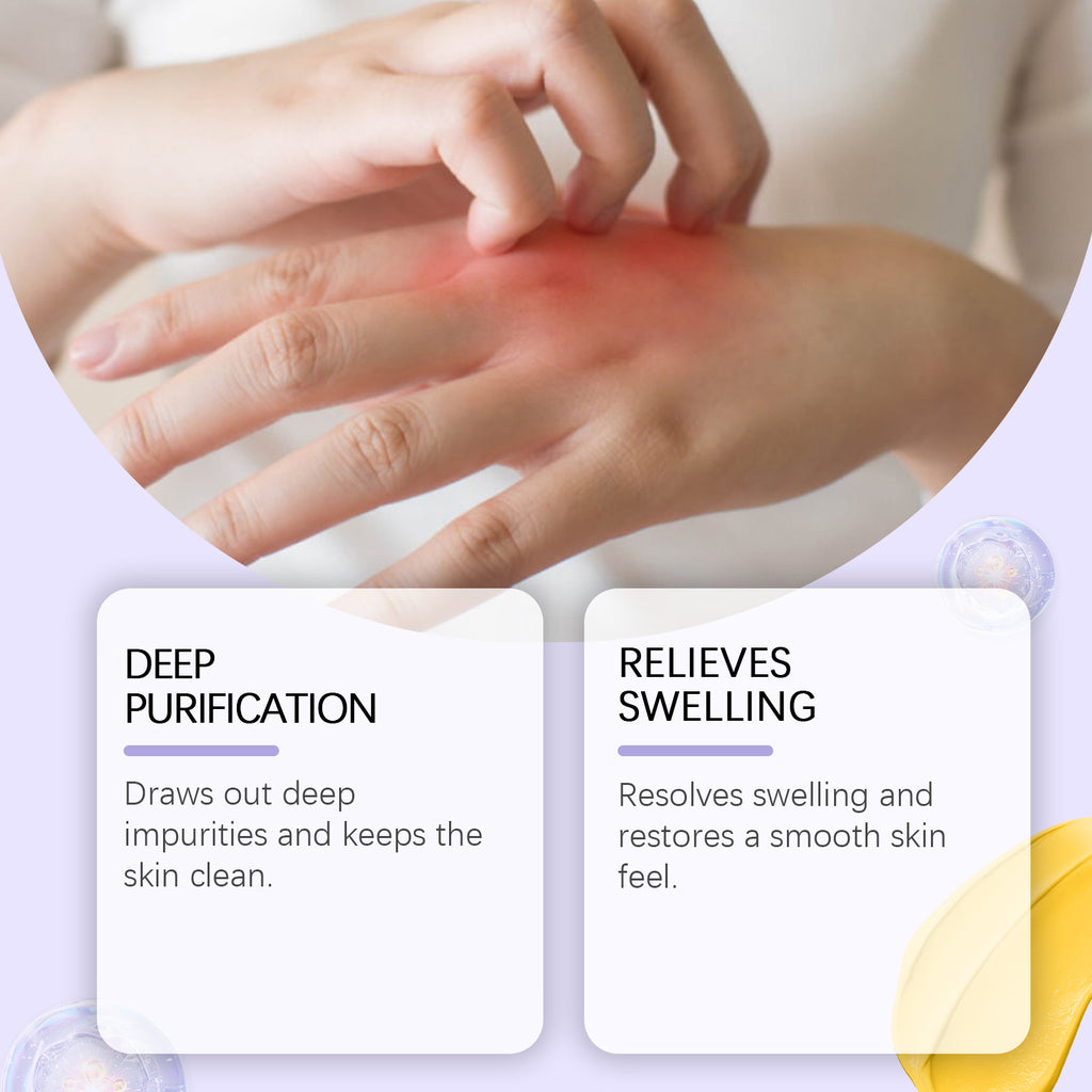 Houkea Propolis Body Care Cream, Nourishes Skin Care For Discomfort Gently Apply Skin Body Care Cream by Josla