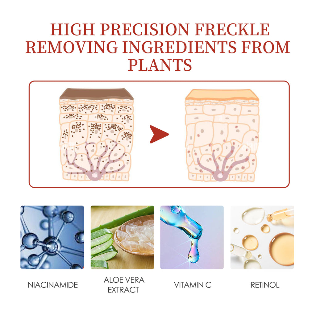 EELHOE Color Repair Cream Replenishes, Moisturizes, And Lightens Freckles, Black Spots, Blemishes, Melasma, And Melanin Skin Cream by Josla