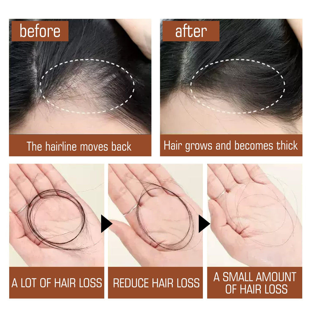 Batana Oil Hair Conditioner, Natural Batana Oil For Hair Growth For Healthier Thicker Hair, Stimulates Hair Follicles by Josla