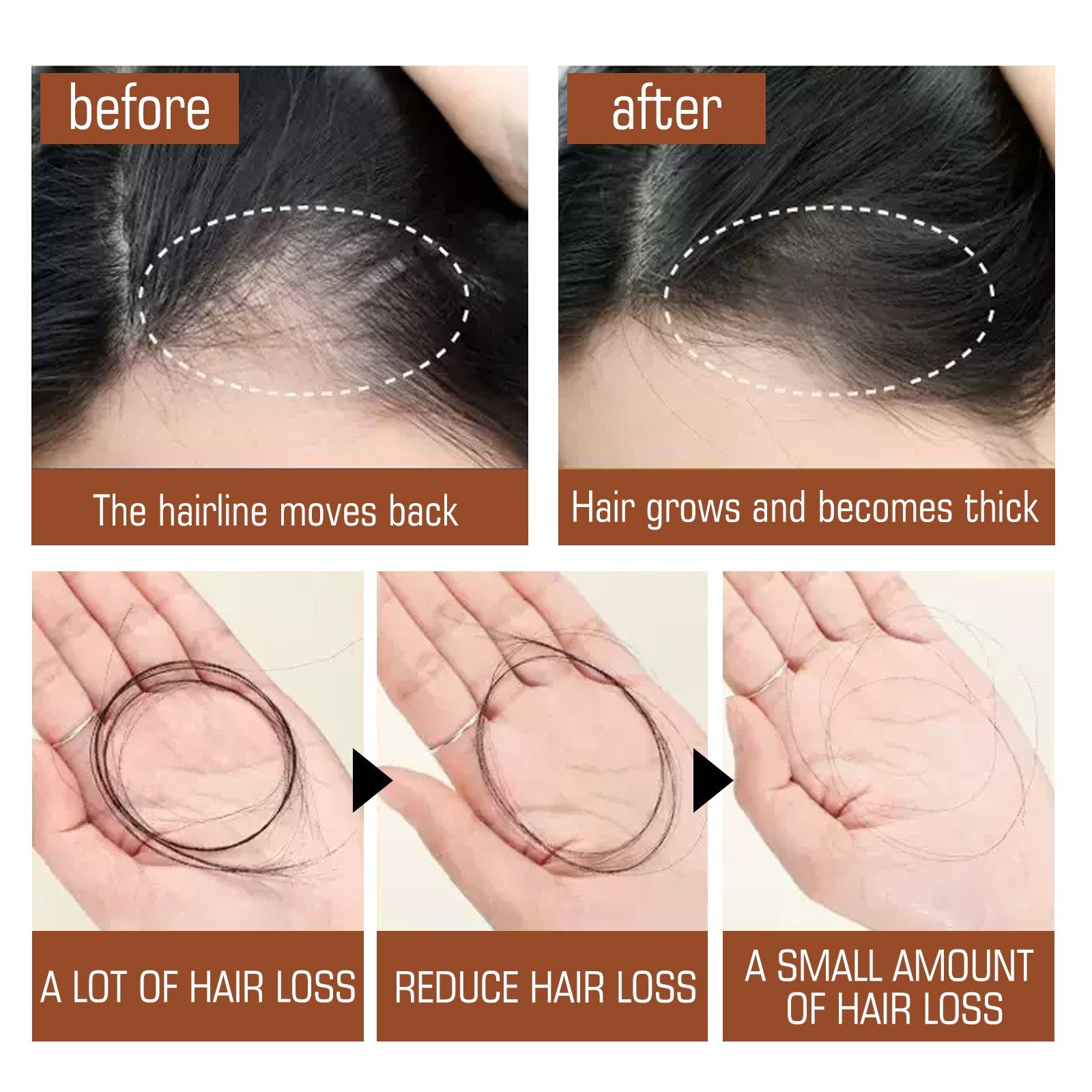 Batana Oil Hair Conditioner, Natural Batana Oil For Hair Growth For Healthier Thicker Hair, Stimulates Hair Follicles by Josla