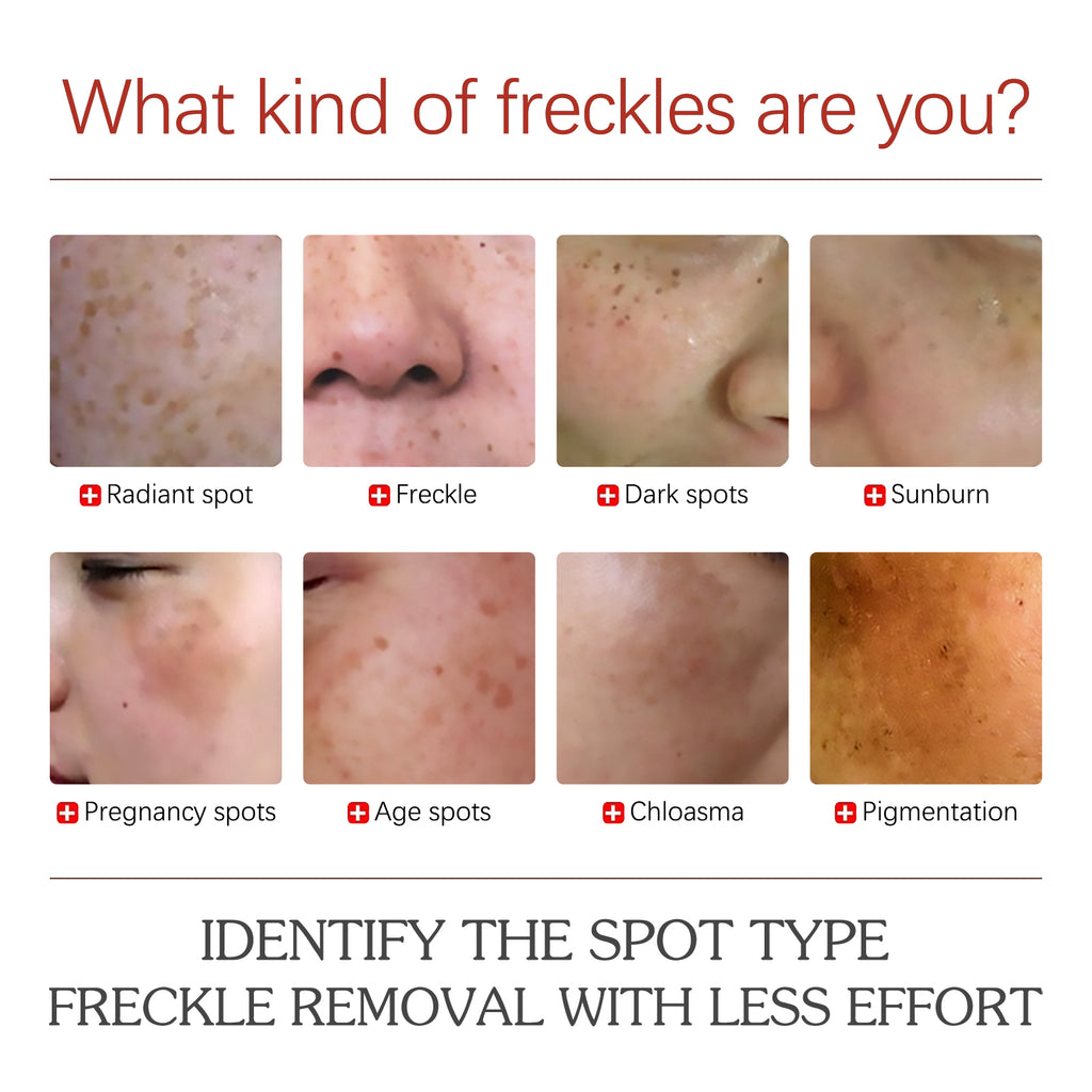 EELHOE Color Repair Cream Replenishes, Moisturizes, And Lightens Freckles, Black Spots, Blemishes, Melasma, And Melanin Skin Cream by Josla