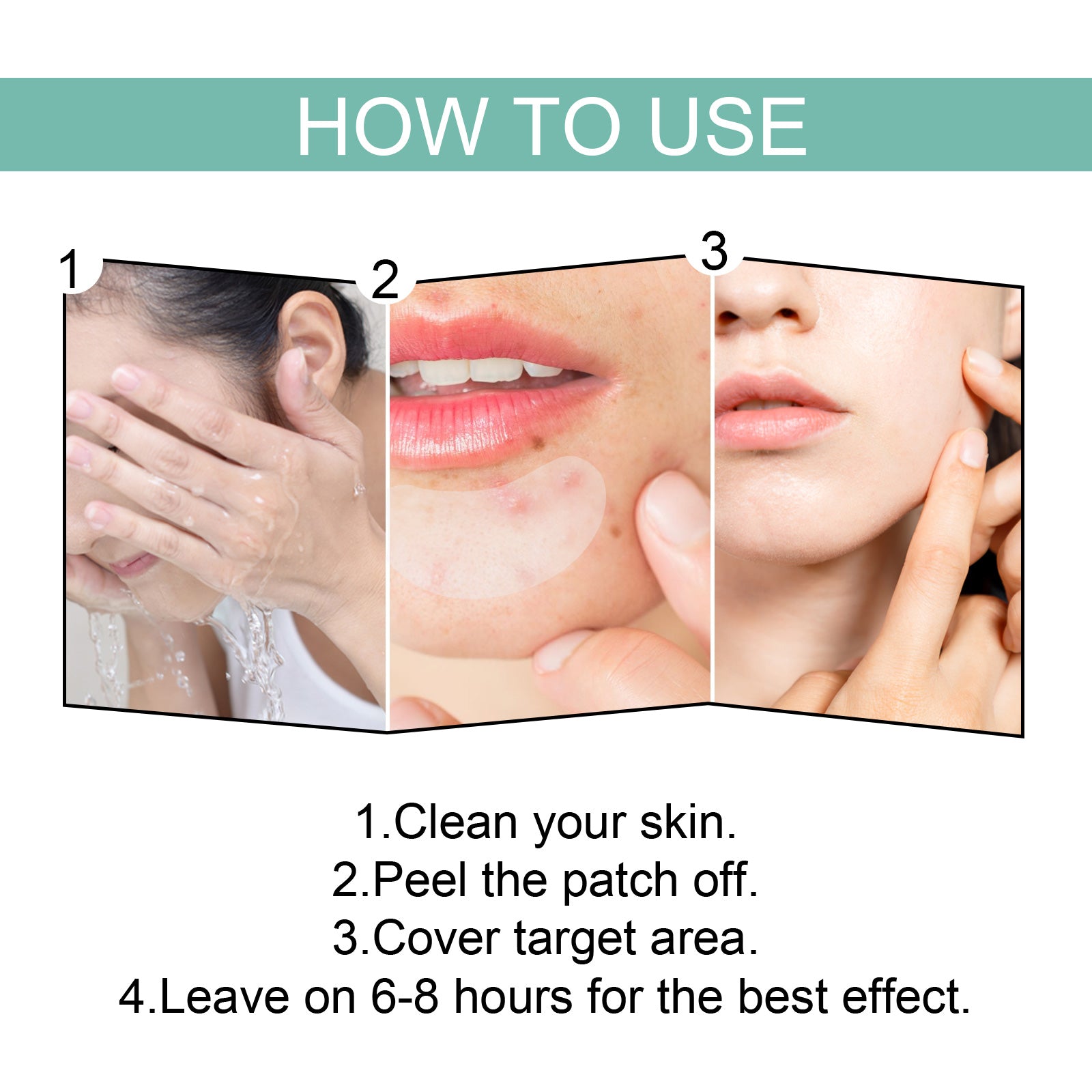 EELHOE Acne Relief Mask Patch Is A Gentle, Non-irritating Acne Mask That Helps To Reduce Acne Marks And Heal Acne. by Josla