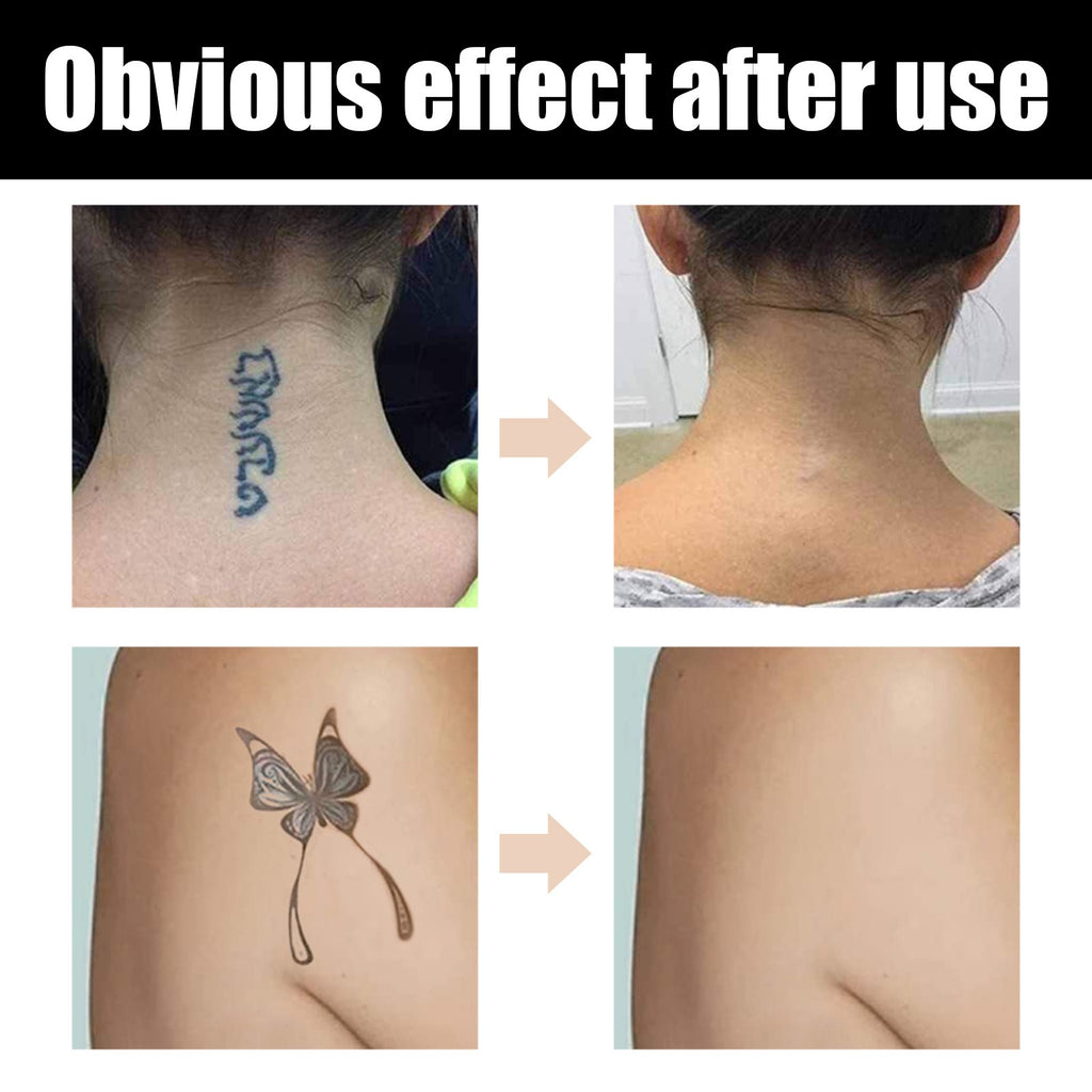 Tattoo Cover Up Makeup Waterproof, Professional Tattoo Concealer Use On Body, For Legs, Dark Spots, Scars, Vitiligo by Josla