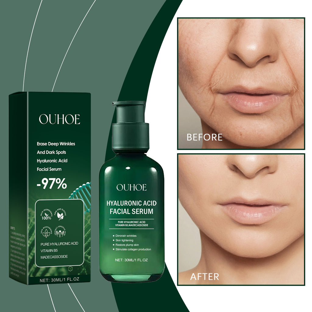 OUHOE Facial Essence, Moisturizing And Moisturizing Skin Brightening Care Gentle Care Of Facial Skin by Josla