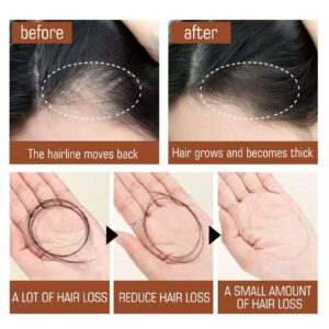 Batana Oil Hair Conditioner, Natural Batana Oil For Hair Growth For Healthier Thicker Hair, Stimulates Hair Follicles - Image 6